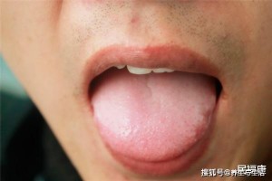 吃饭时总会咬到舌头是想吃肉了没那么简略留神大病来袭