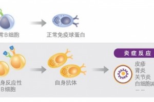 B细胞要害通路敞开狼疮靶向医治新时代